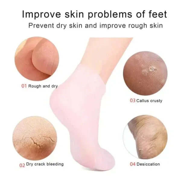 1 Pair Silicone Moisturizing Gel Heel Socks